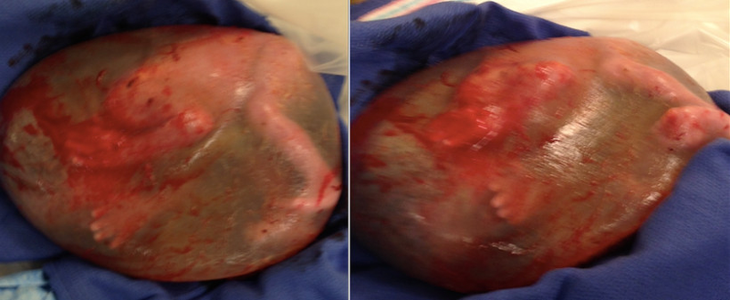 Illustration for article titled Rare Images Of A Baby Born While Still Inside The Amniotic Sac